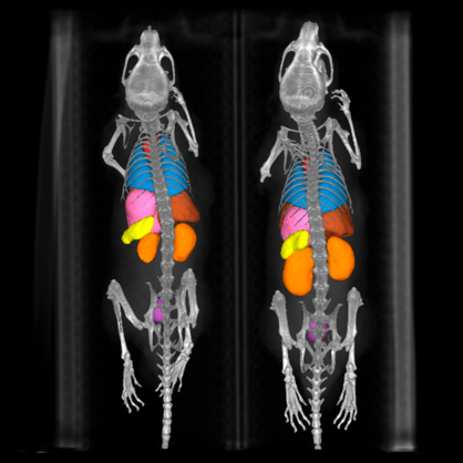 Medical Image