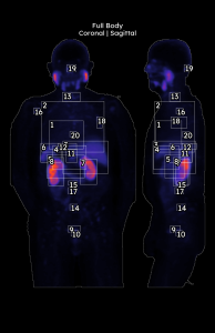 Medical Image