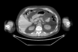 Medical Image