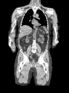 Medical Image