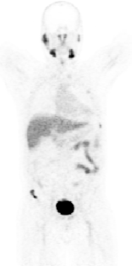 Medical Image